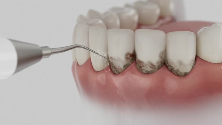 Trusted Wisdom Tooth Removal service in Easton, CA - Dentist Open Now